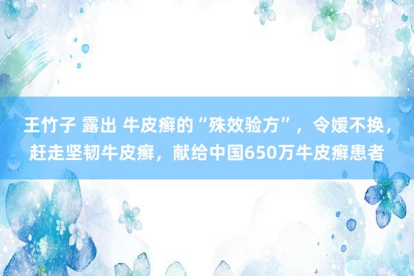 王竹子 露出 牛皮癣的“殊效验方”，令嫒不换，赶走坚韧牛皮癣，献给中国650万牛皮癣患者